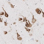 Immunohistochemical staining of human cerebral cortex using Anti-LRRC59 antibody HPA030829.