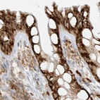 Immunohistochemical staining of human colon using Anti-LRRC59 antibody HPA030829.