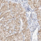 Immunohistochemical staining of human liver using Anti-LRRC59 antibody HPA030829.