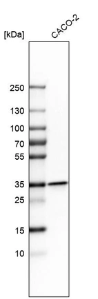 Western blot analysis in human cell line CACO-2.