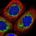 Immunofluorescent staining of human cell line A-431 shows localization to endoplasmic reticulum.