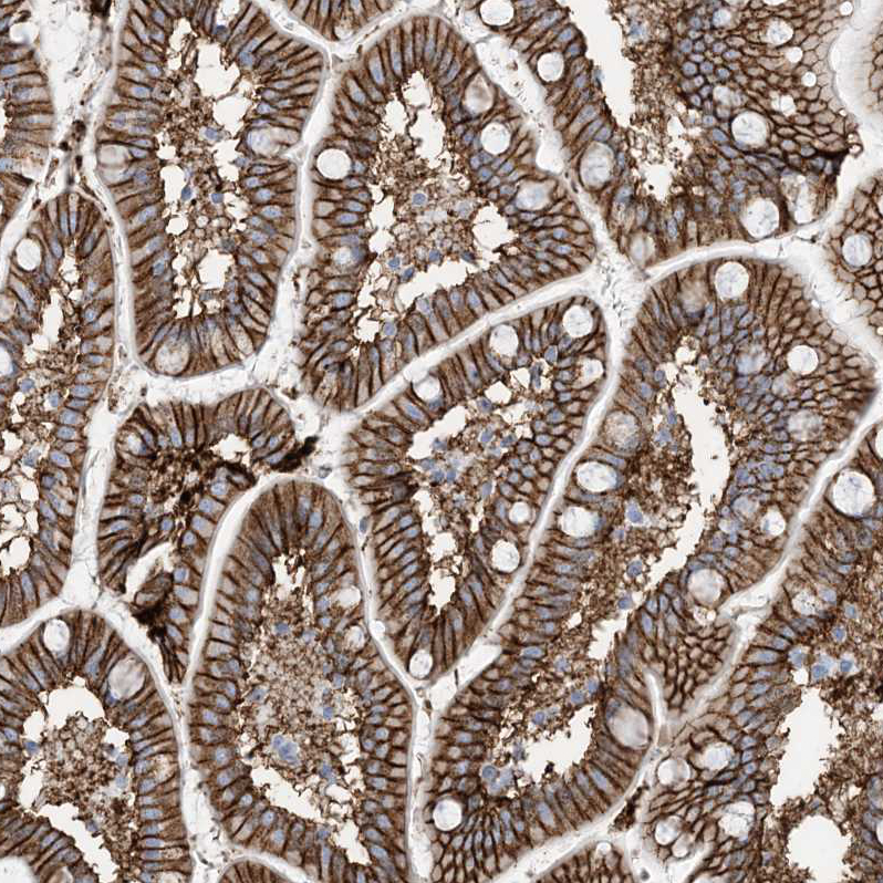 Anti-ATP11C Antibody