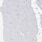 Immunohistochemical staining of human skeletal muscle shows no positivity in myocytes as expected.