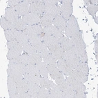Immunohistochemical staining of human skeletal muscle shows no positivity in myocytes as expected.