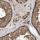 Immunohistochemical staining of human testis shows high expression.