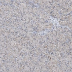 Immunohistochemical staining of human pancreas shows low expression as expected.