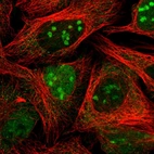 Immunofluorescent staining of human cell line U-2 OS shows localization to nucleus & nucleoli.
