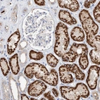 Immunohistochemical staining of human kidney shows strong granular cytoplasmic positivity in cells in tubules.