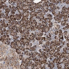 Immunohistochemical staining of human pancreas shows strong granular cytoplasmic positivity in exocrine glandular cells.