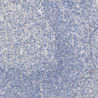 Anti-GPC4 Antibody