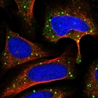 Immunofluorescent staining of human cell line U-2 OS shows localization to vesicles.