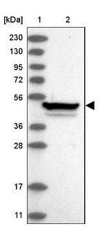 Lane 1: Marker [kDa] 230, 130, 95, 72, 56, 36, 28, 17, 11_br/_Lane 2: Human cell line RT-4