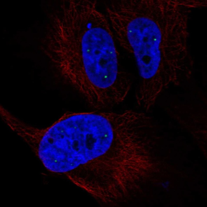 Anti-ZNF239 Antibody