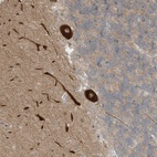 Anti-CNKSR1 Antibody