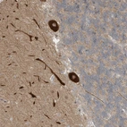 Anti-CNKSR1 Antibody