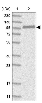 Lane 1: Marker [kDa] 230, 130, 95, 72, 56, 36, 28, 17, 11_br/_Lane 2: Human cell line RT-4