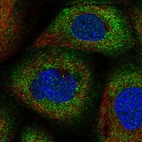Immunofluorescent staining of human cell line A-431 shows localization to cytosol.