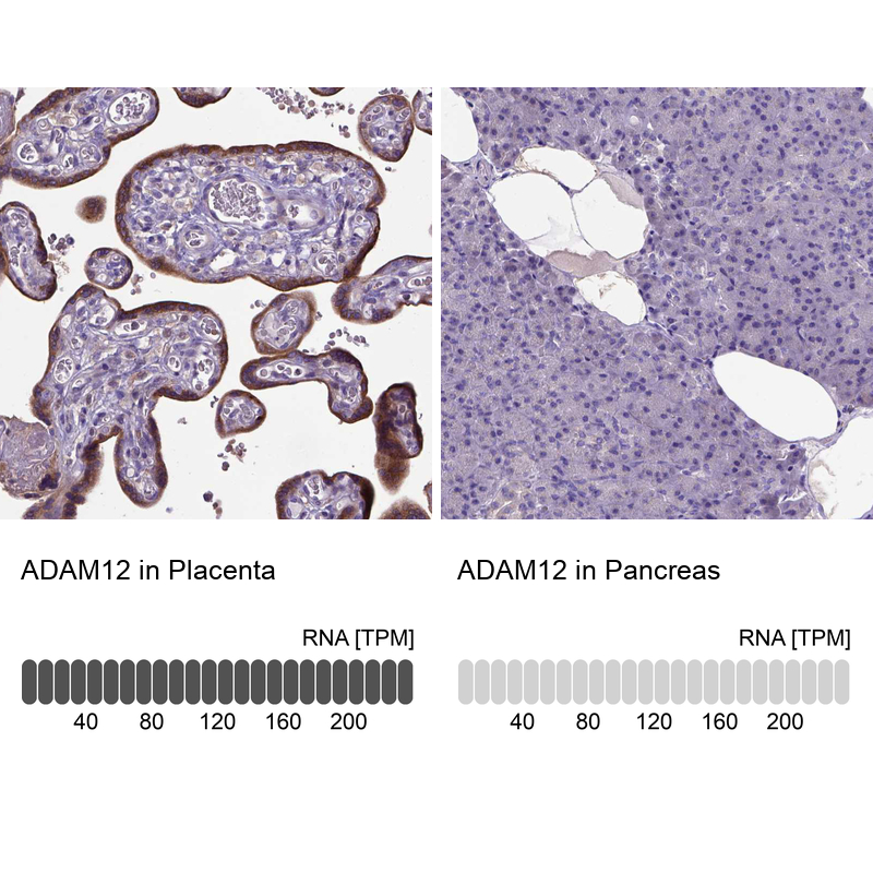 Anti-ADAM12 Antibody