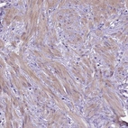 Immunohistochemical staining of human smooth muscles shows moderate positivity.