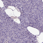 Immunohistochemical staining of human pancreas shows no positivity in exocrine glandular cells as expected.