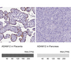 Anti-ADAM12 Antibody