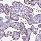 Immunohistochemical staining of human placenta shows moderate positivity in trophoblastic cells.