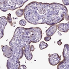 Immunohistochemical staining of human placenta shows moderate positivity in trophoblastic cells.