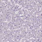 Immunohistochemical staining of human liver shows no positivity in hepatocytes as expected.