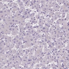 Immunohistochemical staining of human liver shows no positivity in hepatocytes as expected.