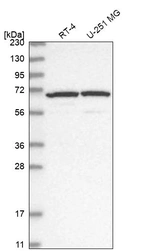 Western blot analysis in human cell line RT-4 and human cell line U-251 MG.