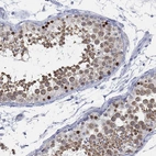 Immunohistochemical staining of human testis shows high expression.