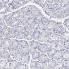 Immunohistochemical staining of human stomach shows low expression as expected.