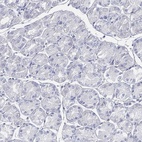 Anti-GCNA Antibody