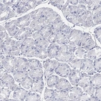 Immunohistochemical staining of human stomach shows low expression as expected.