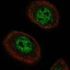 Immunofluorescent staining of human cell line hTCEpi shows localization to nucleoplasm.