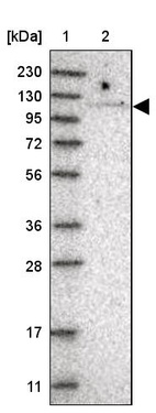 Lane 1: Marker [kDa] 230, 130, 95, 72, 56, 36, 28, 17, 11_br/_Lane 2: Human cell line RT-4