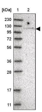 Lane 1: Marker [kDa] 230, 130, 95, 72, 56, 36, 28, 17, 11_br/_Lane 2: Human cell line RT-4