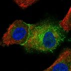 Immunofluorescent staining of human cell line A549 shows localization to plasma membrane & cytosol.