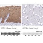 Anti-KRT13 Antibody