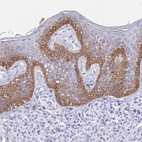 Immunohistochemical staining of human skin shows positivity in epidermal cells.