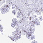 Immunohistochemical staining of human prostate shows positivity in the basal layer.