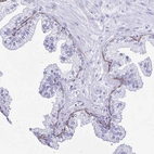 Immunohistochemical staining of human prostate shows positivity in the basal layer.