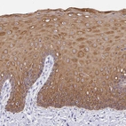 Immunohistochemical staining of human cervix shows positivity in squamous epithelial cells.