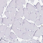 Immunohistochemical staining of human skeletal muscle shows no positivity in myocytes as expected.