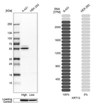 Western blot analysis in human cell lines A-431 and HEK293 using Anti-KRT13 antibody. Corresponding KRT13 RNA-seq data are presented for the same cell lines. Loading control: Anti-GAPDH.