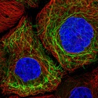 Immunofluorescent staining of human cell line A-431 shows localization to intermediate filaments.