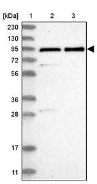 Lane 1: Marker [kDa] 230, 130, 95, 72, 56, 36, 28, 17, 11_br/_Lane 2: Human cell line RT-4_br/_Lane 3: Human cell line U-251MG sp