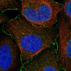 Immunofluorescent staining of human cell line U-2 OS shows localization to nucleoplasm & plasma membrane.