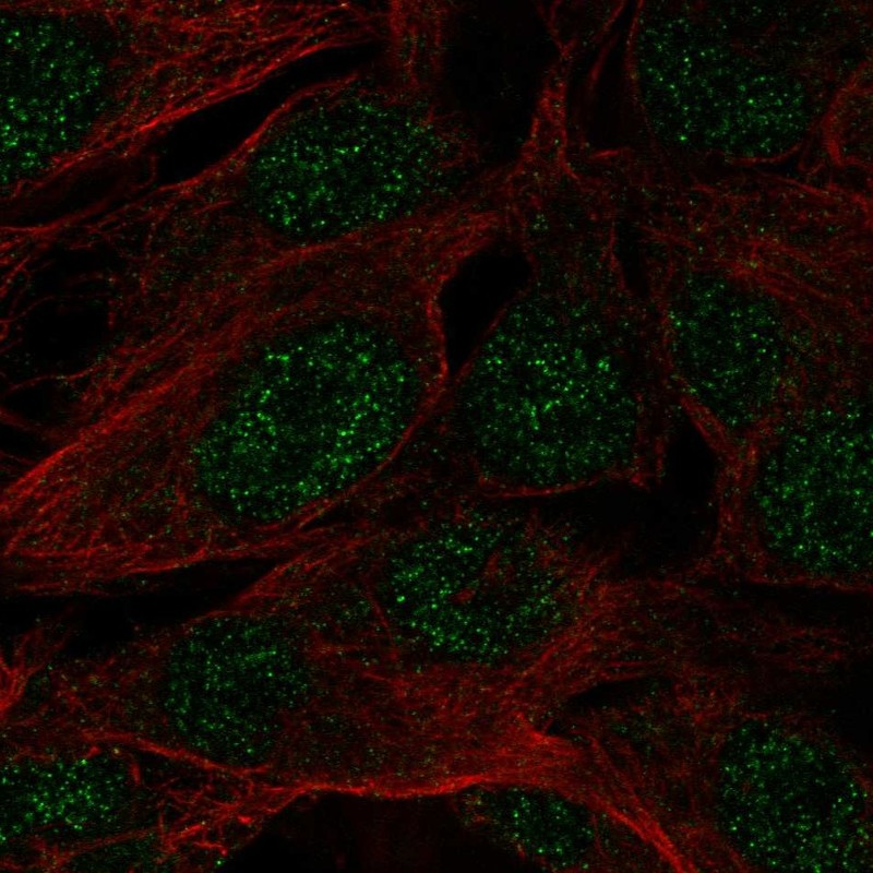 Anti-SPATS1 Antibody