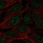 Anti-SPATS1 Antibody